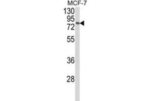 Western Blotting (WB) image for anti-Mitogen-Activated Protein Kinase 8 Interacting Protein 1 (MAPK8IP1) antibody (ABIN3004004) (MAPK8IP1 antibody)