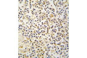 Formalin-fixed and paraffin-embedded human kideny tissue reacted with ALDH1A3 antibody (N-term), which was peroxidase-conjugated to the secondary antibody, followed by DAB staining. (ALDH1A3 antibody  (N-Term))