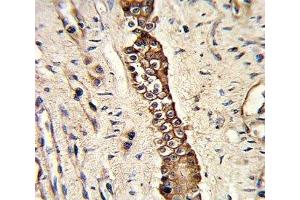IHC analysis of FFPE human normal lung with DDR2 antibody (DDR2 antibody)