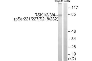 Western blot analysis of extracts from HepG2 cells, treated with EGF (200ng/ml, 30mins), using RSK1/2/3/4 (Phospho-Ser221/227/218/232) antibody. (RSK1/2/3/4 (pSer218), (pSer22), (pSer227), (pSer232) antibody)