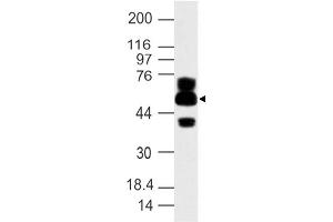 Image no. 1 for anti-ATG16 Autophagy Related 16-Like 1 (ATG16L1) (AA 35-260) antibody (ABIN5027029) (ATG16L1 antibody  (AA 35-260))