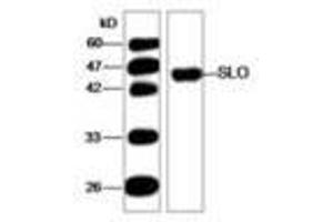 Image no. 1 for anti-Streptolysin O (SLO) (AA 78-206) antibody (ABIN791623) (Streptolysin O antibody  (AA 78-206))