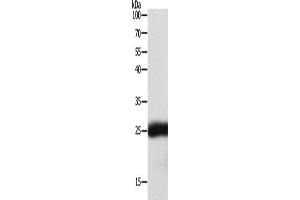 Western Blotting (WB) image for anti-Synaptosomal-Associated Protein, 25kDa (SNAP25) antibody (ABIN2428725) (SNAP25 antibody)