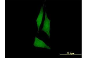 Immunofluorescence of purified MaxPab antibody to PTK6 on HeLa cell. (PTK6 antibody  (AA 1-451))