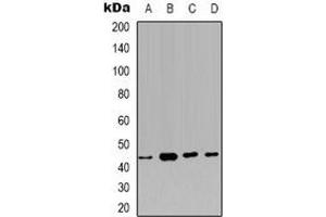 Western blot analysis of Carbonic Anhydrase 12 expression in HEK293T (A), PC3 (B), MCF7 (C), NIH3T3 (D) whole cell lysates. (CA12 antibody)