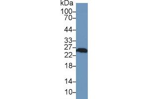 Western Blot; Sample: Human A549 cell lysate; Primary Ab: 1µg/ml Rabbit Anti-Rat UCHL1 Antibody Second Ab: 0. (UCHL1 antibody  (AA 2-223))