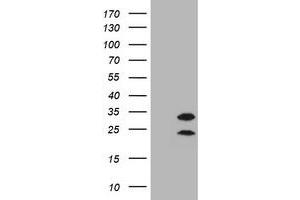 Image no. 3 for anti-Membrane-Spanning 4-Domains, Subfamily A, Member 1 (MS4A1) antibody (ABIN1497206) (CD20 antibody)