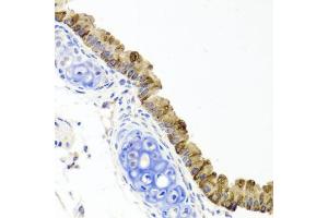 Immunohistochemistry of paraffin-embedded mouse lung using TOPBP1 antibody (ABIN6291480) at dilution of 1:100 (40x lens). (TOPBP1 antibody)