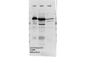 Image no. 2 for anti-Transportin 1 (TNPO1) antibody (ABIN108619) (Transportin 1 antibody)