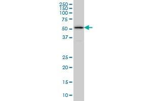 Western Blotting (WB) image for anti-Zinc Finger Protein 259 (znf259) (AA 361-460) antibody (ABIN598588) (ZNF259 antibody  (AA 361-460))