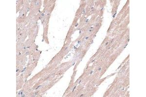Immunohistochemistry of paraffin-embedded Mouse heart using PPT2 Polyclonal Antibody at dilution of 1:100 (40x lens). (PPT2 antibody)