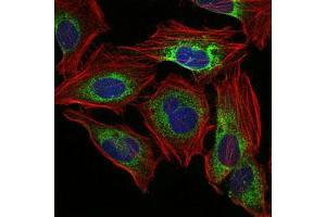 Immunofluorescence (IF) image for anti-Protein Phosphatase 2A Activator, Regulatory Subunit 4 (PPP2R4) antibody (ABIN969557)