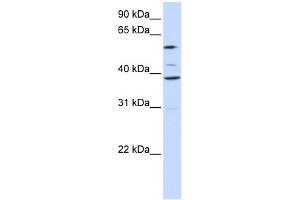 WB Suggested Anti-SLC25A16 Antibody Titration:  0. (SLC25A16 antibody  (Middle Region))