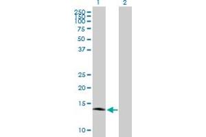 Western Blotting (WB) image for IFITM1 293T Cell Transient Overexpression Lysate(Denatured) (ABIN1334128)