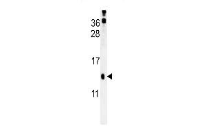 Western blot analysis in mouse kidney tissue lysates (15ug/lane). (PLA2G16 antibody  (C-Term))