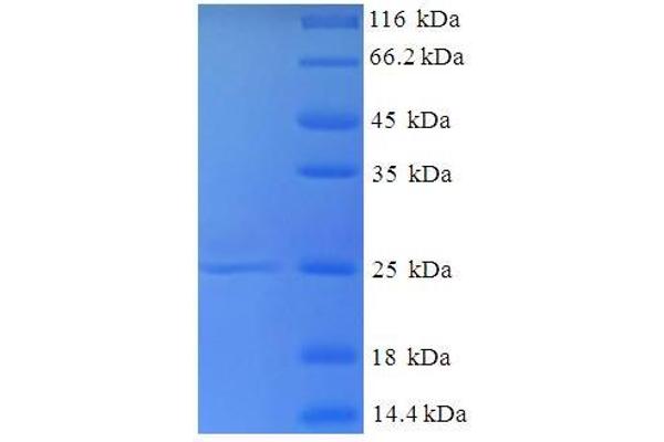 SELT Protein (AA 20-195) (His tag)