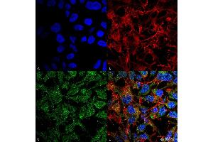 Immunocytochemistry/Immunofluorescence analysis using Rabbit Anti-BDNF Polyclonal Antibody . (BDNF antibody  (N-Term))