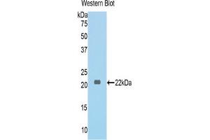 Western blot analysis of the recombinant protein. (COL6A1 antibody  (AA 624-800))