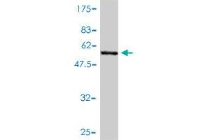 Western Blot detection against Immunogen (54. (PGAM1 antibody  (AA 1-254))