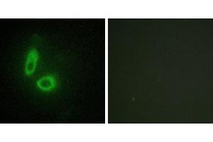 Peptide - +Western blot analysis of extracts from 293 cells and Jurkat cells, using EFNA1 antibody. (Ephrin A1 antibody  (Internal Region))