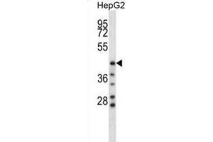 Western Blotting (WB) image for anti-Hyaluronidase-1 (HYAL1) antibody (ABIN2998320) (HYAL1 antibody)