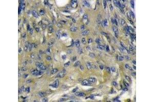 VEGFD antibody immunohistochemistry analysis in formalin fixed and paraffin embedded mouse heart tissue. (VEGFD antibody  (AA 322-352))
