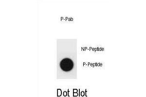 Dot blot analysis of mouse TSC1 Antibody (Phospho ) Phospho-specific Pab (ABIN1881918 and ABIN2839929) on nitrocellulose membrane. (TSC1 antibody  (pThr1043))