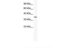 YBX2 antibody  (AA 178-227)