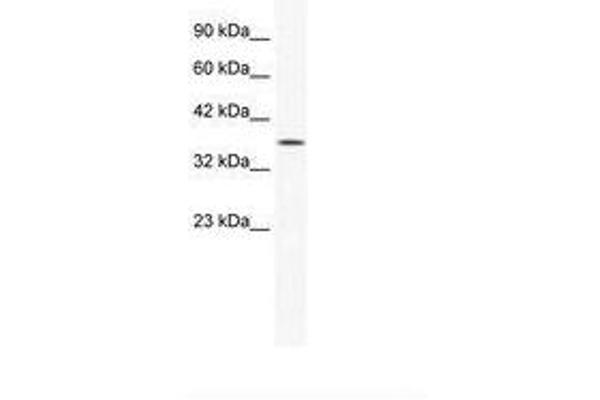 YBX2 antibody  (AA 178-227)