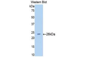 Western blot analysis of the recombinant protein. (SIRT4 antibody  (AA 60-255))