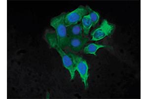 Human pancreatic carcinoma cell line MIA PaCa-2 was stained with Mouse Anti-Cytokeratin 8-FITC followed by DAPI. (KRT8 antibody  (C-Term) (FITC))