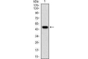 Western blot analysis using WT1 mAb against human WT1 (AA: 314-479) recombinant protein. (WT1 antibody  (AA 314-479))