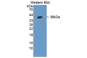 Figure. (GBP4 antibody  (AA 1-304))
