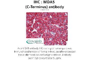Image no. 4 for anti-Interferon Induced with Helicase C Domain 1 (IFIH1) antibody (ABIN1736854) (IFIH1 antibody)