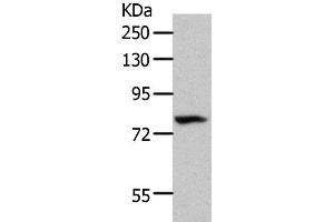 Western Blot analysis of 293T cell using CD10 Polyclonal Antibody at dilution of 1:700 (MME antibody)