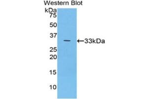Western Blotting (WB) image for anti-Ceruloplasmin (Ferroxidase) (CP) (AA 789-1065) antibody (ABIN1858368) (Ceruloplasmin antibody  (AA 789-1065))