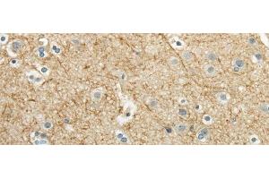 Immunohistochemistry of paraffin-embedded Human brain using WNT2 Polyclonal Antibody at dilution of 1/40 (WNT2 antibody)