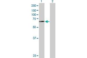 Western Blot analysis of BIRC2 expression in transfected 293T cell line by BIRC2 MaxPab polyclonal antibody. (BIRC2 antibody  (AA 1-618))