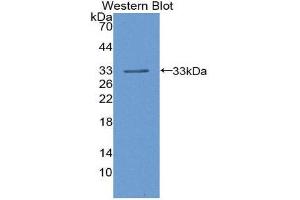 Western Blotting (WB) image for anti-Lipoprotein Lipase (LPL) (AA 55-316) antibody (ABIN1078293) (Lipoprotein Lipase antibody  (AA 55-316))