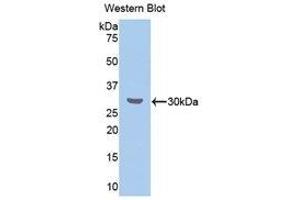 Western Blotting (WB) image for anti-Cholesteryl Ester Transfer Protein (CETP) (AA 232-487) antibody (ABIN1858369) (CETP antibody  (AA 232-487))