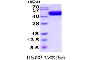 SDS-PAGE (SDS) image for Interleukin 5 Receptor, alpha (IL5RA) (AA 18-339) protein (His tag) (ABIN5854571) (IL5RA Protein (AA 18-339) (His tag))