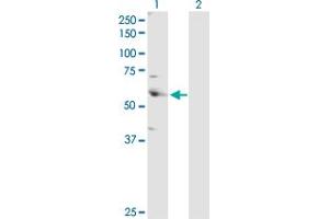 Western Blot analysis of CSTF2 expression in transfected 293T cell line by CSTF2 MaxPab polyclonal antibody. (CSTF2 antibody  (AA 1-577))