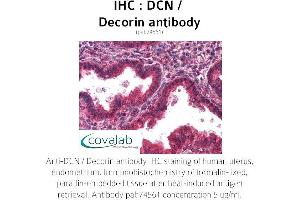 Image no. 1 for anti-Decorin (DCN) antibody (ABIN1733549) (Decorin antibody)