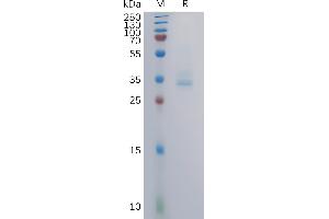 Human GB Protein, mFc Tag on SDS-PAGE under reducing condition. (GPRC5B Protein (AA 33-56) (mFc Tag))
