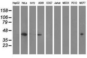 Image no. 2 for anti-Mevalonate Kinase (MVK) antibody (ABIN1499604) (MVK antibody)