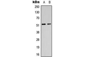 Western blot analysis of CHRM1 expression in HeLa (A), mouse brain (B) whole cell lysates. (CHRM1 antibody  (Center))