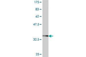 Western Blot detection against Immunogen (35. (Retinoic Acid Receptor gamma antibody  (AA 43-132))