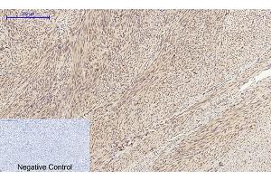 Immunohistochemical analysis of paraffin-embedded human uterus tissue. (Cyclin A antibody  (AA 190-270))