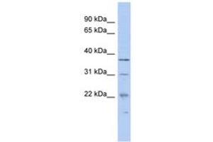 Image no. 1 for anti-Malignant T Cell Amplified Sequence 1 (MCTS1) (N-Term) antibody (ABIN6743006) (MCTS1 antibody  (N-Term))