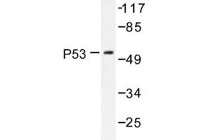 Image no. 1 for anti-Tumor Protein P53 (TP53) antibody (ABIN272049) (p53 antibody)